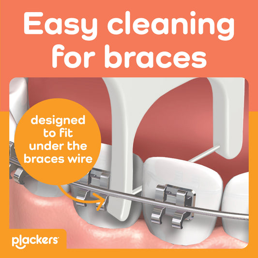 Plackers OrthoPick® Floss Picks Designed for Braces, Tuffloss® Made Without PTFE, FlipPick® Clean Between Brackets
