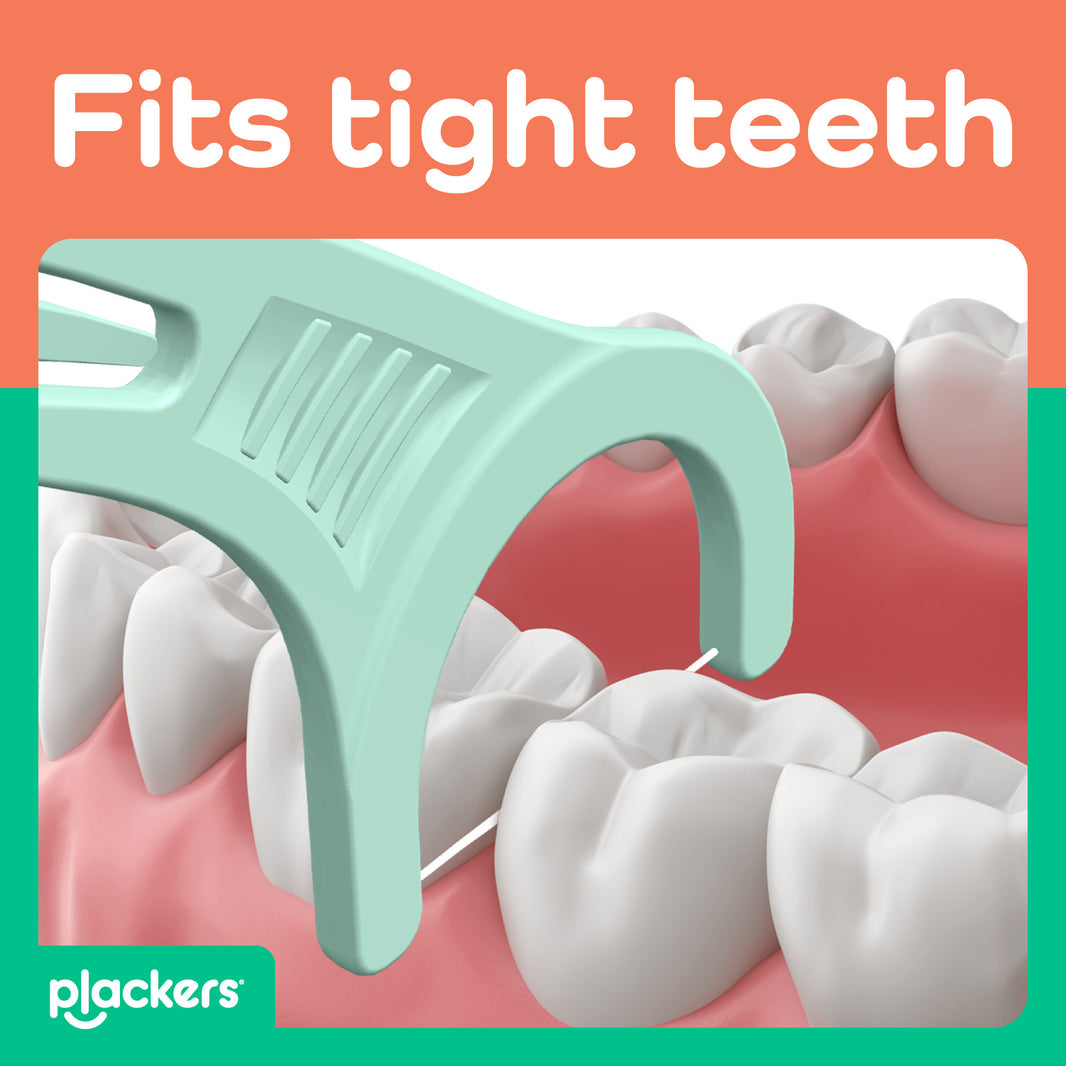 Flossers – Plackers